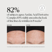 Azelaic Acid Derivative Complex 10% M7