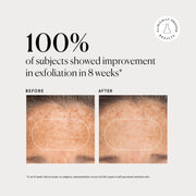 BHA Liquid Exfoliant 2% E2