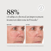Vitamin C Super Serum Plus - Jumbo X8