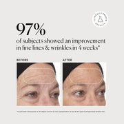 Retinol Complex Serum M4