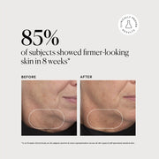 Retinol Complex Serum M4