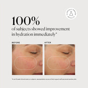 Plant Ceramide Rich Moisture Cream P2